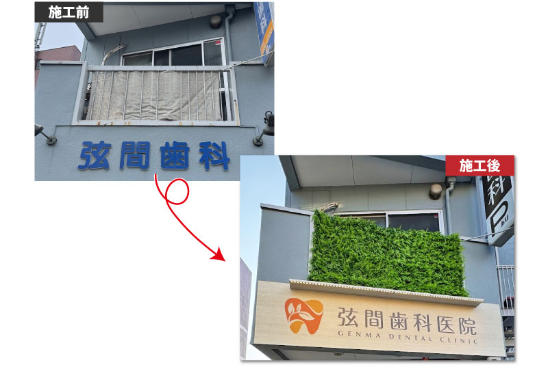 蕨市歯科医院のバルコニーをフェイクグリーンで目隠し